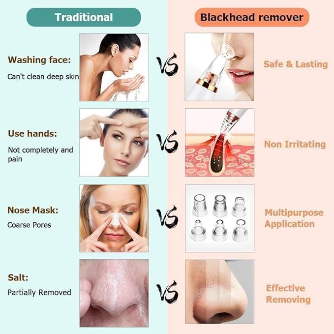6-in-1 Electric Blackhead Remover Vacuum | USB Rechargeable Pore Cleaner