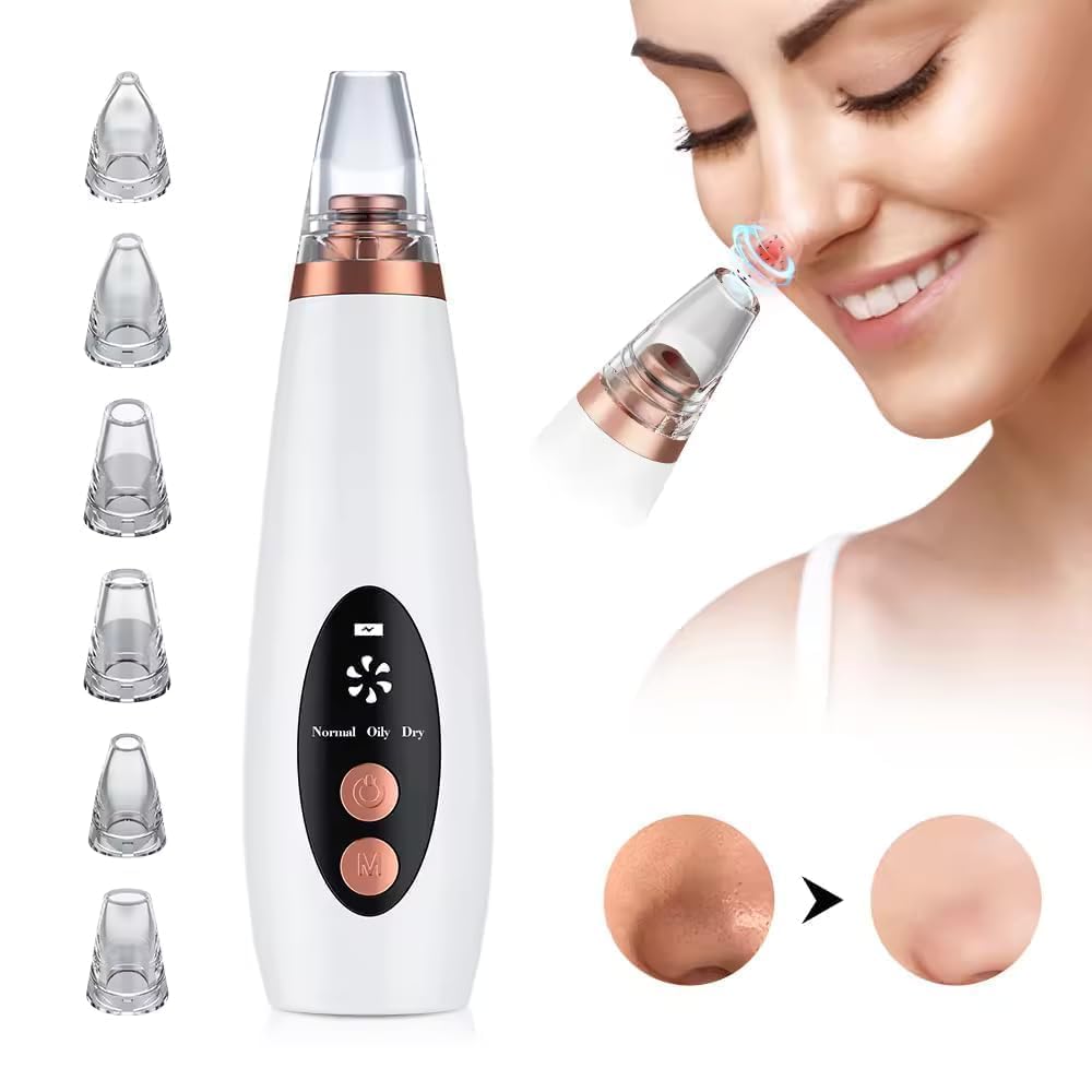 6-in-1 Electric Blackhead Remover Vacuum | USB Rechargeable Pore Cleaner
