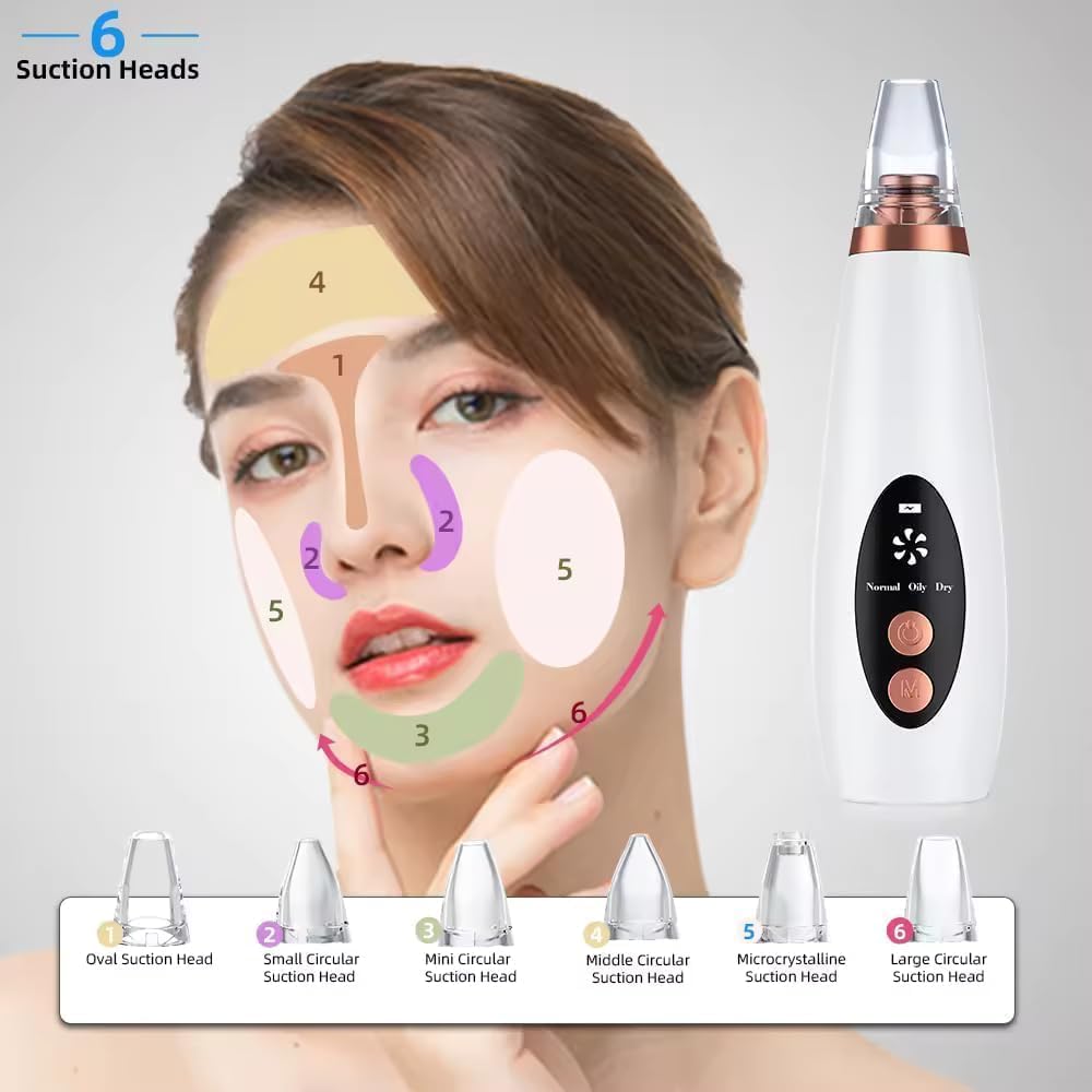 6-in-1 Electric Blackhead Remover Vacuum | USB Rechargeable Pore Cleaner